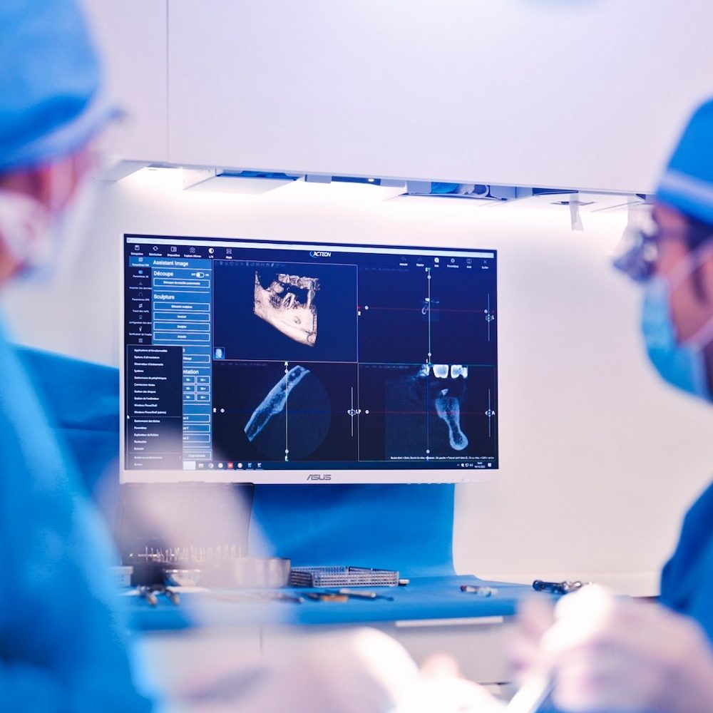 Chirurgie guidée